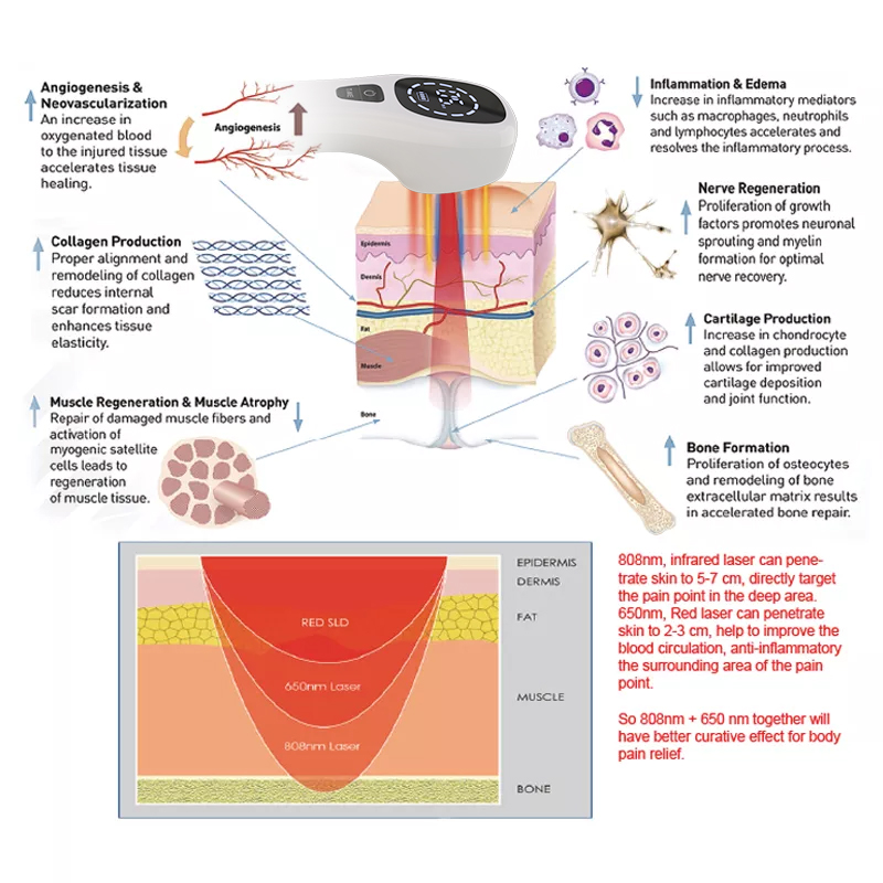 2x808nm Cold Laser Therapy Dev - Badminton Bag ulasan dan harga